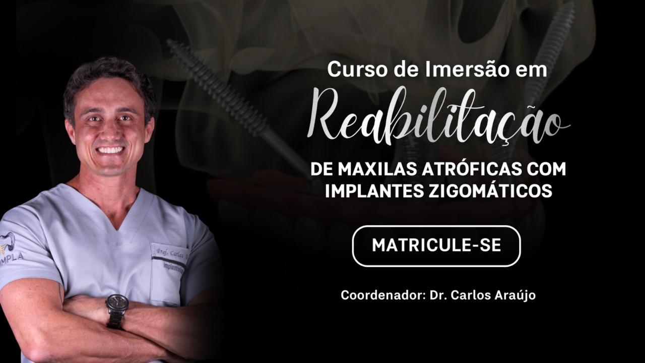 Mentoria em Reabilitação com Implantes Zigomáticos